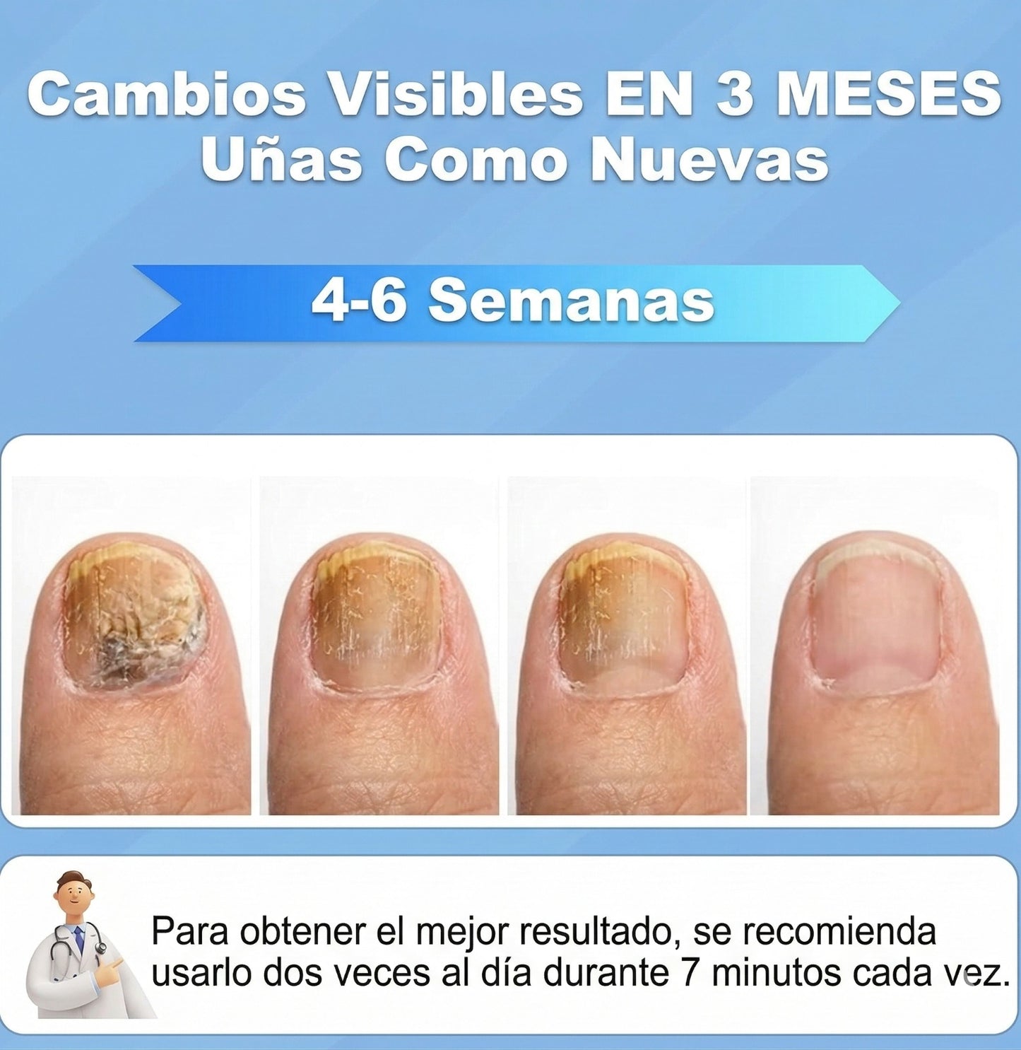 Lámpara UV Antihongos – Tratamiento para Uñas – Ayuda a Combatir Hongos en Casa